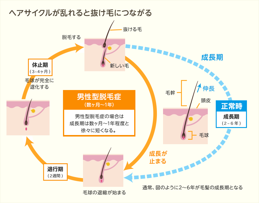 正常の毛周期とAGAの毛周期